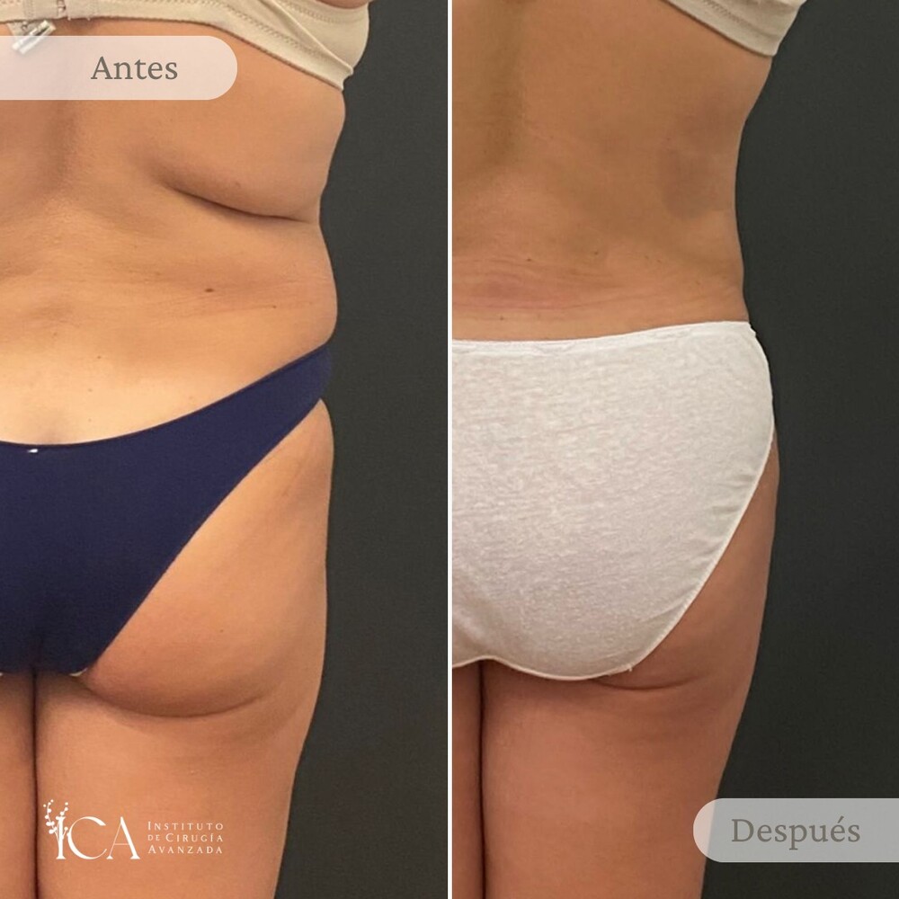 Clinic Results Gallery